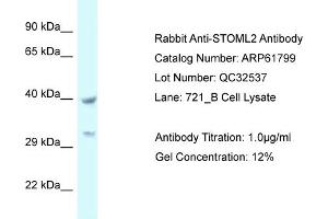 Western Blotting (WB) image for anti-Stomatin (EPB72)-Like 2 (STOML2) (C-Term) antibody (ABIN2788905) (STOML2 Antikörper  (C-Term))