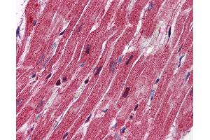 Anti-Nestin antibody IHC of human heart. (Nestin Antikörper  (AA 1295-1344))