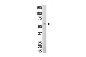 Western Blotting (WB) image for anti-Proto-oncogene tyrosine-protein kinase Src (Src) antibody (ABIN387822)