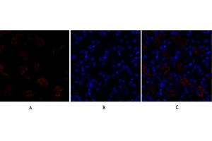 Immunofluorescence analysis of mouse kidney tissue. (Dynamin 1-Like Antikörper)