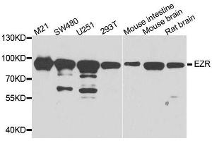 Western blot analysis of extracts of various cell lines, using EZR antibody. (Ezrin Antikörper  (AA 350-470))