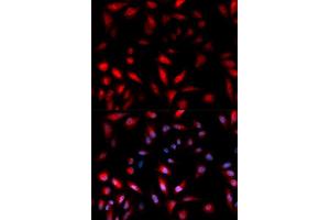 Immunofluorescence (IF) image for anti-Heat Shock 27kDa Protein 1 (HSPB1) (pSer82) antibody (ABIN1870246) (HSP27 Antikörper  (pSer82))