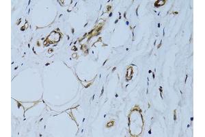 Immunohistochemistry of paraffin-embedded human breast using MCAM antibody (ABIN6290150) at dilution of 1:100 (40x lens). (MCAM Antikörper)