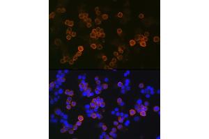 Immunofluorescence analysis of Raw264 7 cells using iNOS Rabbit mAb (ABIN1678965, ABIN3018084, ABIN3018085 and ABIN7101575) at dilution of 1:100 (40x lens). (NOS2 Antikörper)