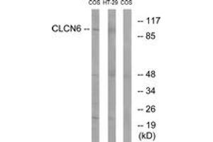 Western Blotting (WB) image for anti-Chloride Channel, Voltage-Sensitive 6 (CLCN6) (AA 611-660) antibody (ABIN2890213) (CLCN6 Antikörper  (AA 611-660))