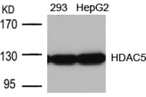 Image no. 1 for anti-Histone Deacetylase 5 (HDAC5) (AA 496-500) antibody (ABIN197341) (HDAC5 Antikörper  (AA 496-500))