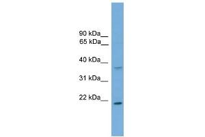 WB Suggested Anti-GSTM1 Antibody Titration:  0. (GSTM1 Antikörper  (C-Term))