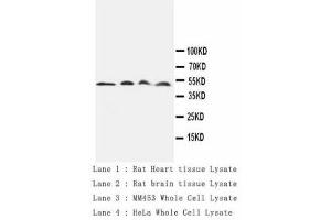 Image no. 1 for anti-Cathepsin D (CTSD) antibody (ABIN1502057) (Cathepsin D Antikörper)