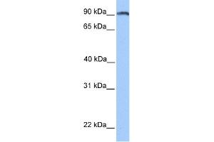 WB Suggested Anti-ANKS3 Antibody Titration: 0. (ANKS3 Antikörper  (N-Term))