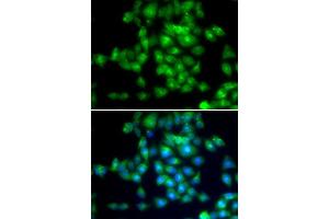 Immunofluorescence analysis of MCF-7 cells using SIRT3 antibody. (SIRT3 Antikörper  (C-Term))