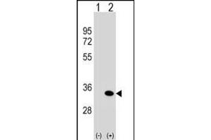 Western Blotting (WB) image for anti-ATG5 Autophagy Related 5 (ATG5) (AA 209-238), (C-Term) antibody (ABIN388519)