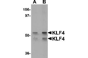 Western Blotting (WB) image for anti-Kruppel-Like Factor 4 (Gut) (KLF4) (C-Term) antibody (ABIN1030469) (KLF4 Antikörper  (C-Term))