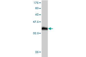 Western Blot detection against Immunogen (36. (OXSR1 Antikörper  (AA 351-450))