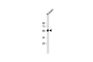 Anti-beta Tubulin Antibody at 1:2000 dilution + Mouse brain lysate Lysates/proteins at 20 μg per lane. (TUBB Antikörper  (AA 298-328))