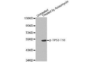 Western blot analysis of extracts from MDA cells, using phospho-TP53-T18 antibody. (p53 Antikörper  (pThr18))