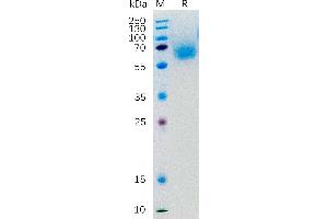 Human K Protein, hFc Tag on SDS-PAGE under reducing condition. (KLRG1 Protein (Fc Tag))