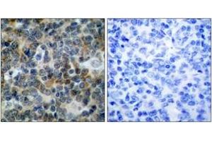 Immunohistochemistry (IHC) image for anti-Vasodilator-Stimulated phosphoprotein (VASP) (pSer238) antibody (ABIN605395) (VASP Antikörper  (pSer238))