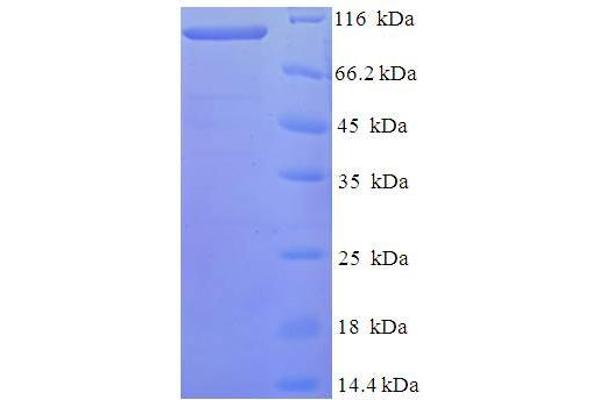 FAM160B1 Protein (AA 1-738, Isoform 2) (His-SUMO Tag)