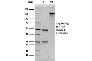 SDS-PAGE Analysis Purified Prolactin Mouse Monoclonal Antibody (PRL/2643). (Prolactin Antikörper  (AA 63-201))