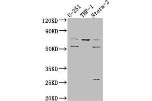 Western Blot Positive WB detected in: U-251 whole cell lysate, THP-1 whole cell lysate, Ntera-2 whole cell lysate All lanes: PTH1R antibody at 1:1000 Secondary Goat polyclonal to rabbit IgG at 1/50000 dilution Predicted band size: 67 kDa Observed band size: 72, 55 kDa (Rekombinanter PTH1R Antikörper)