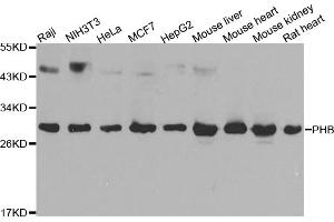 Western blot analysis of extracts of various cell lines, using PHB antibody. (Prohibitin Antikörper)