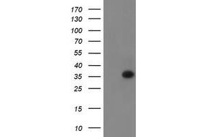 Image no. 1 for anti-RING1 and YY1 Binding Protein (RYBP) antibody (ABIN1500777) (RYBP Antikörper)