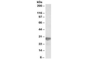 Western blot testing of HeLa lysate with NNMT antibody at 0. (NNMT Antikörper)