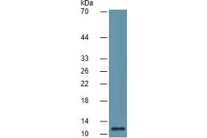 Western Blotting (WB) image for Interleukin 8 (IL8) ELISA Kit (ABIN6730859)