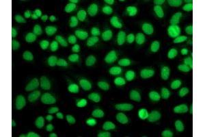 Immunofluorescence (IF) image for anti-Fibroblast Growth Factor Receptor 2 (FGFR2) antibody (ABIN1498250) (FGFR2 Antikörper)