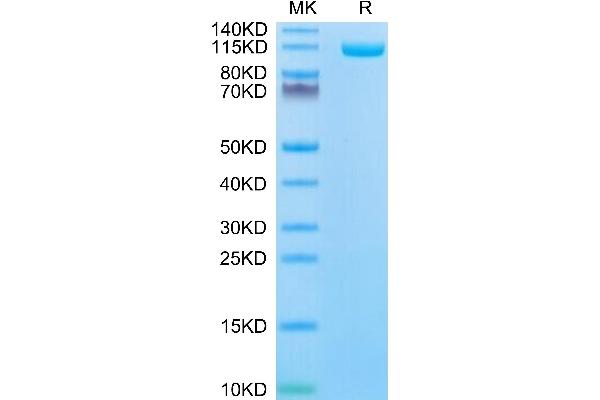 ENPP1 Protein (AA 98-925) (His-Avi Tag,Biotin)