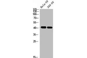 Western blot analysis of HELA-UV 293T-UV using p-Rad51 (T309) antibody. (RAD51 Antikörper  (pThr309))