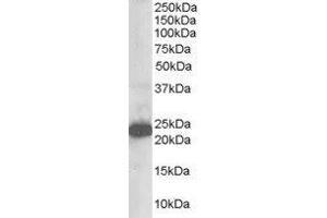ABIN2560214 staining (1µg/ml) of Human Brain lysate (RIPA buffer, 35µg total protein per lane). (STMN2 Antikörper  (N-Term))