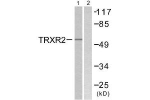 Western Blotting (WB) image for anti-Thioredoxin Reductase 2 (TXNRD2) (C-Term) antibody (ABIN1848862) (TXNRD2 Antikörper  (C-Term))