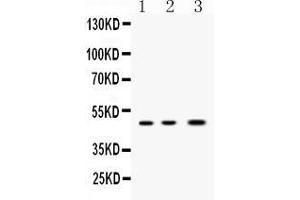 Western blot analysis of Nanog expression in rat ovary extract ( Lane 1), mouse ovary extract ( Lane 2) and MCF-7 whole cell lysates ( Lane 3). (Nanog Antikörper  (Middle Region))