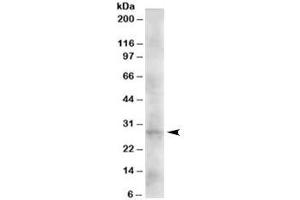 Western blot testing of human heart lysate with DKK2 antibody at 2ug/ml. (DKK2 Antikörper)