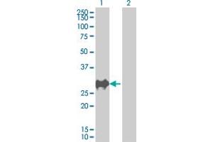 Western Blot analysis of CDKN1B expression in transfected 293T cell line by CDKN1B MaxPab polyclonal antibody. (CDKN1B Antikörper  (AA 1-198))