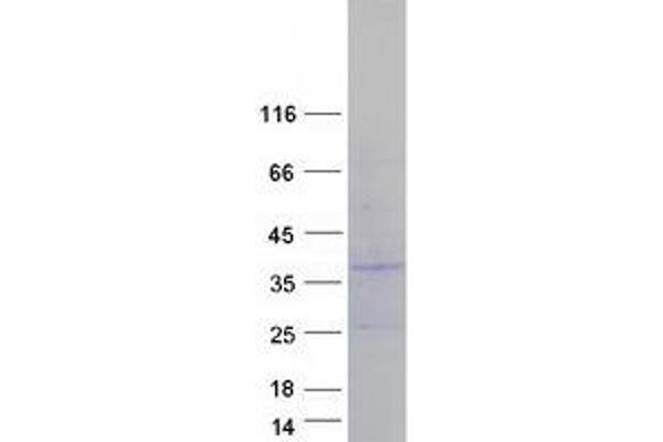 PIGX Protein (Transcript Variant 1) (Myc-DYKDDDDK Tag)