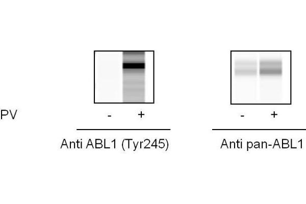 ABL1 ELISA Kit