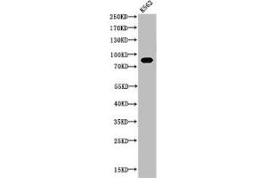 Western Blot analysis of K562 cells using Acetyl-HSP 90 (K292/284) Polyclonal Antibody (HSP9AA1 (acLys284), (acLys292) Antikörper)