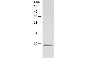 Western Blotting (WB) image for Dynein, Light Chain, LC8-Type 1 (DYNLL1) (AA 1-89) protein (His tag) (ABIN7122721) (DYNLL1 Protein (AA 1-89) (His tag))