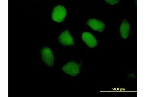 Immunofluorescence of purified MaxPab antibody to ZNF547 on HeLa cell. (ZNF547 Antikörper  (AA 1-402))