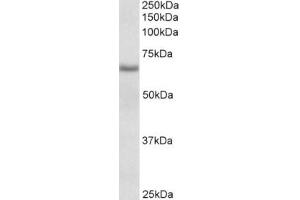 Western Blotting (WB) image for anti-Cytochrome B5 Reductase 4 (CYB5R4) (Internal Region) antibody (ABIN2465085) (CYB5R4 Antikörper  (Internal Region))