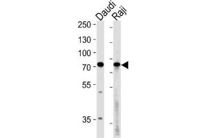 Western Blotting (WB) image for anti-Germ Cell Associated 2 (Haspin) (GSG2) antibody (ABIN3003656) (GSG2 Antikörper)