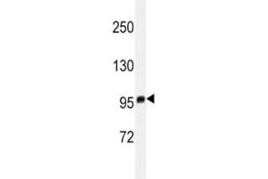 Western blot analysis of EZH2 antibody in T47D lysate. (EZH2 Antikörper)