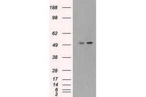 HEK293T cells were transfected with the pCMV6-ENTRY control (Left lane) or pCMV6-ENTRY CD4 (Right lane) cDNA for 48 hrs and lysed. (CD4 Antikörper)