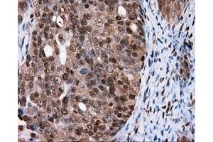 Immunohistochemical staining of paraffin-embedded colon tissue using anti-FAHD2A mouse monoclonal antibody. (FAHD2A Antikörper)