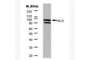 Western Blotting (WB) image for anti-Programmed Cell Death 6 Interacting Protein (PDCD6IP) antibody (ABIN2477348) (ALIX Antikörper)