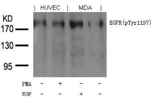 Image no. 1 for anti-Epidermal Growth Factor Receptor (EGFR) (pTyr1197) antibody (ABIN401612) (EGFR Antikörper  (pTyr1197))