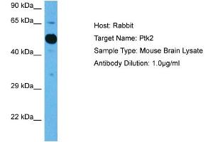 Host: Mouse Target Name: PTK2 Sample Tissue: Mouse Brain Antibody Dilution: 1ug/ml (FAK Antikörper  (Middle Region))