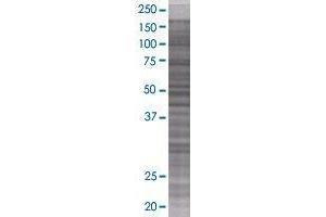 SFRS15 transfected lysate. (SFRS15 293T Cell Transient Overexpression Lysate(Denatured))